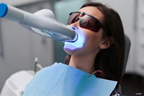 Discover the Magic of Professional Teeth Whitening